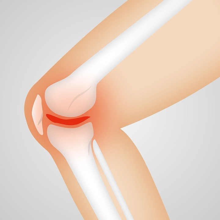zastrzyki z kwasu hialuronowego w kolano